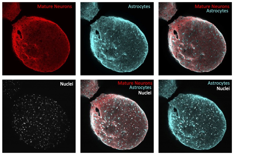 MAP2, PAX6 and DAPI staining of mature neurons, astrocytes and nuclei.