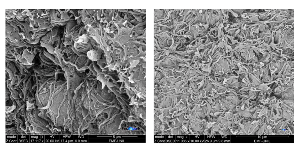 Neurons in neurosphere, electron microscopy.